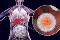 1 hepatita c jpg jpeg