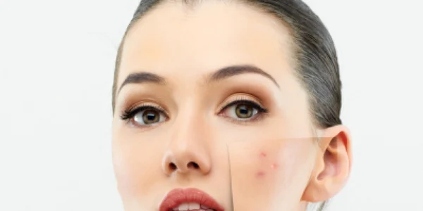 cosmetica