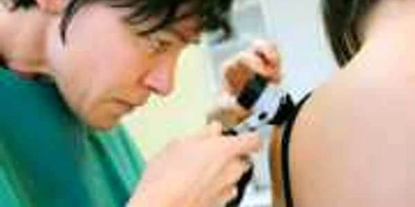 Număr record de români cu cancer de piele