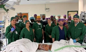 The surgical team poses with Mercy and Goodness Gemini Untwined jpg