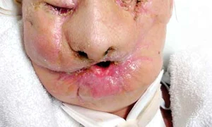 Americanca Charla Nash după tragedie (Fotografii: Reuters) jpeg