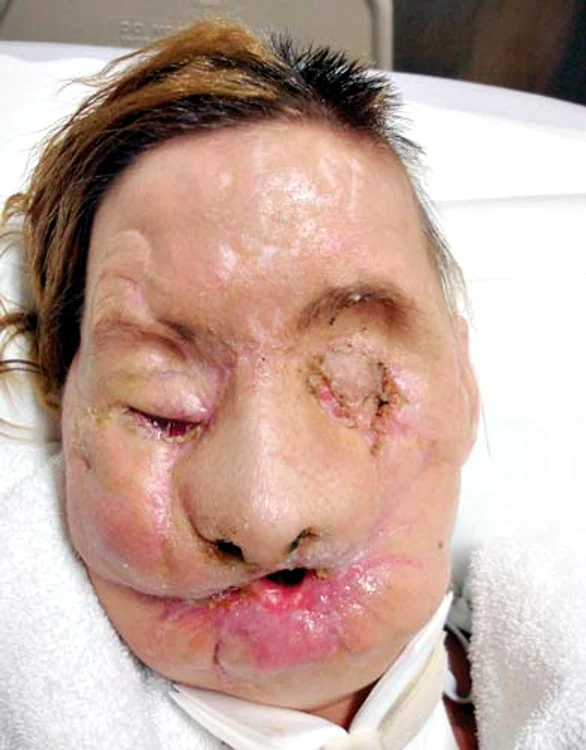 Americanca Charla Nash după tragedie (Fotografii: Reuters)