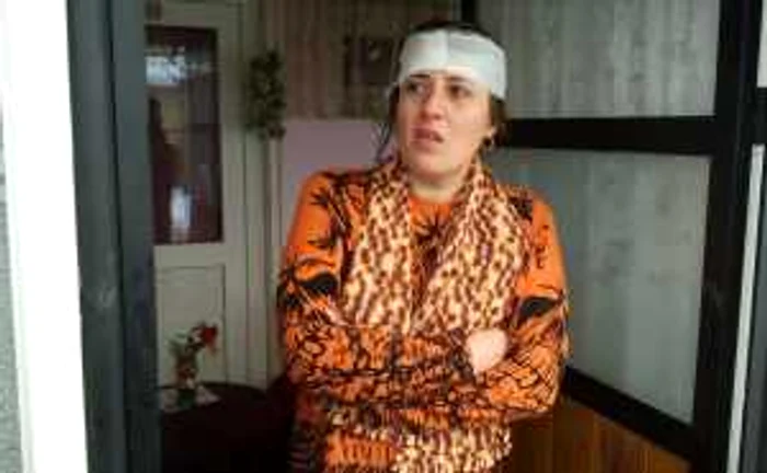 Femeia rănită în urma incendiului