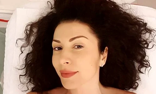 carmen bruma operatii estetice jpeg