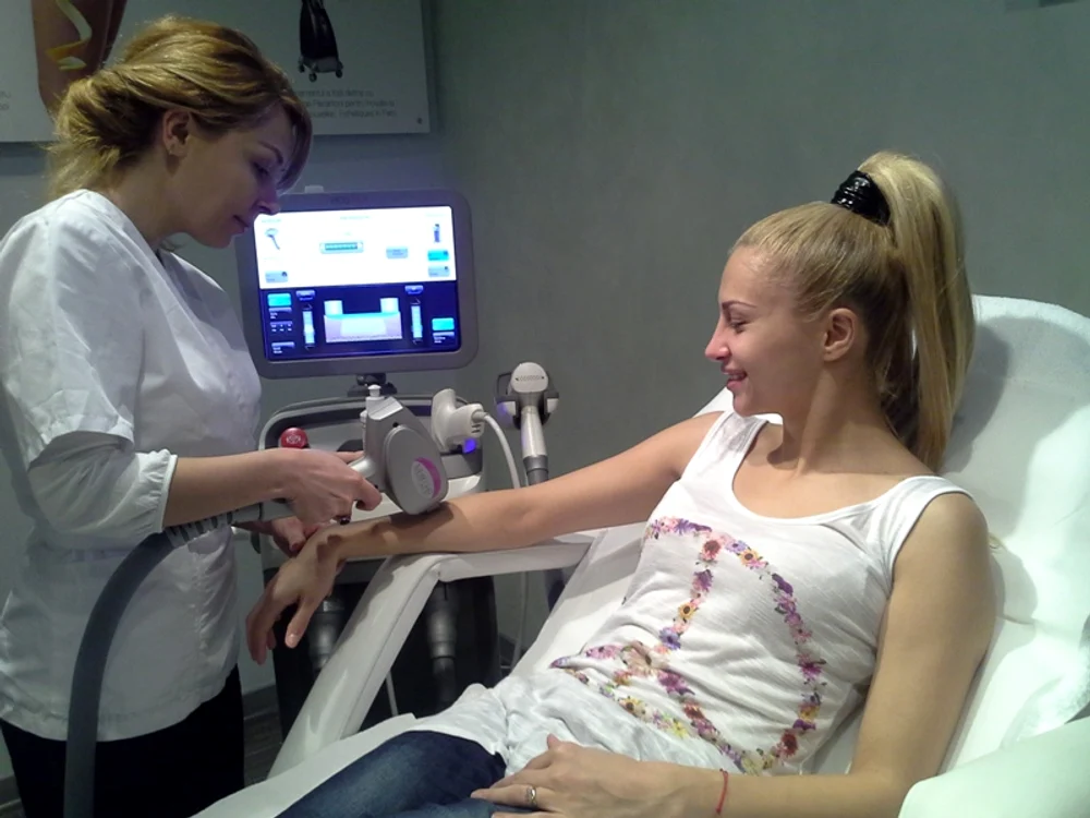epilare definitiva