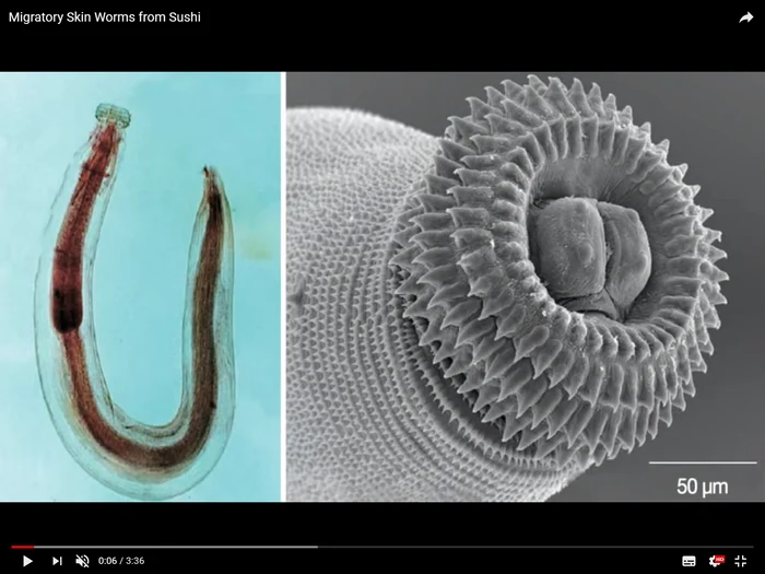 
    O tânără a mâncat pește și a contactat un virus care i-a pus viața în pericolFoto: Youtube  