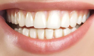 rolul igienei orale corecte in mentinerea sanatatii generale jpg