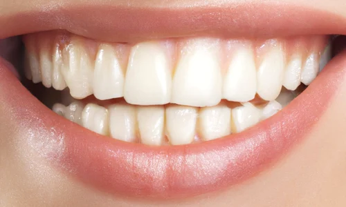 rolul igienei orale corecte in mentinerea sanatatii generale jpg