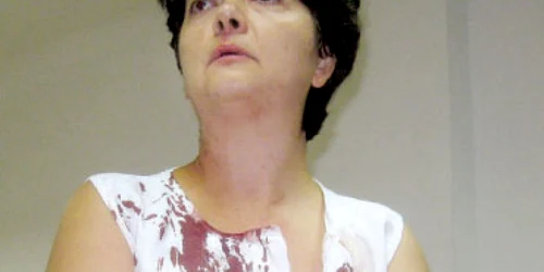 Avocată bătută de un grup de rromi