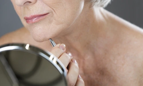 penseta_hisutism_shutterstock 407570620 jpg