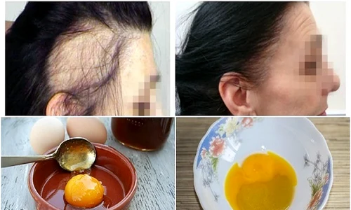 1 tratament eficient pentru cresterea si regenerarea parului se prepara cu ingrediente pe care le ai in casa tp5p jpg jpeg