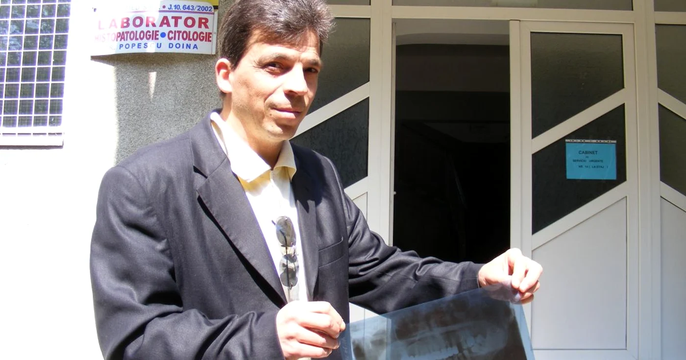 Nicolae Socoleanu cu radiografia dentară care confirmă că va ramane fără dinţi
