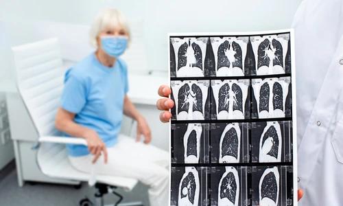 1 tomografie jpg jpeg