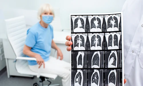 1 tomografie jpg jpeg