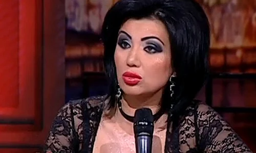 Buzele Adrianei sunt încă inflamate după intervenție jpeg