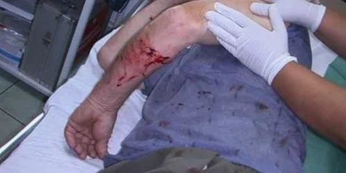 Pietonii au consumat băuturi alcoolice 