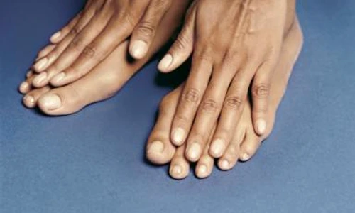 lipsa de calciu semne jpeg