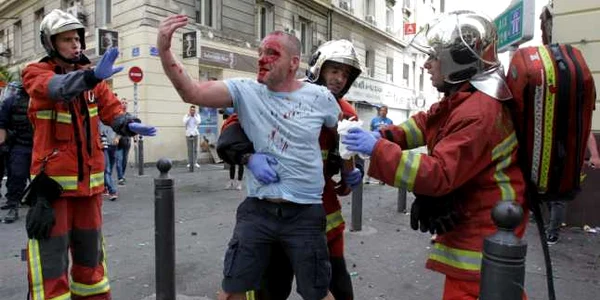 Un fan englez este plin de sânge după ce s-a încăierat cu suporterii ruşi înainte de meciul de fotbal dintre Anglia şi Rusia la Euro 2016 în Franţa FOTO AFP Jean Christophe Magnenet