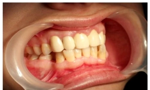 1 52256 original jpg jpeg