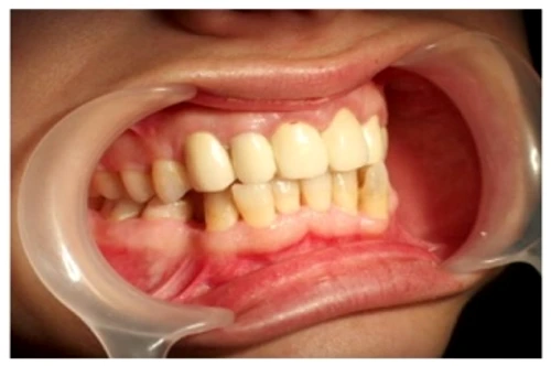 1 52256 original jpg jpeg