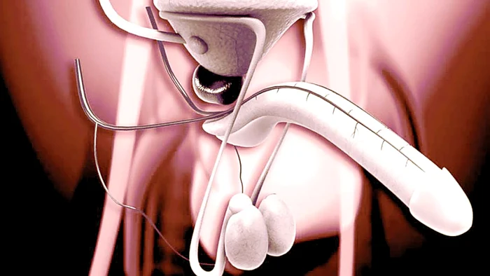 Celule necesare pentru a obţine un nou penis pot fi prelevate şi de la organele sexuale grav rănite sau amputate