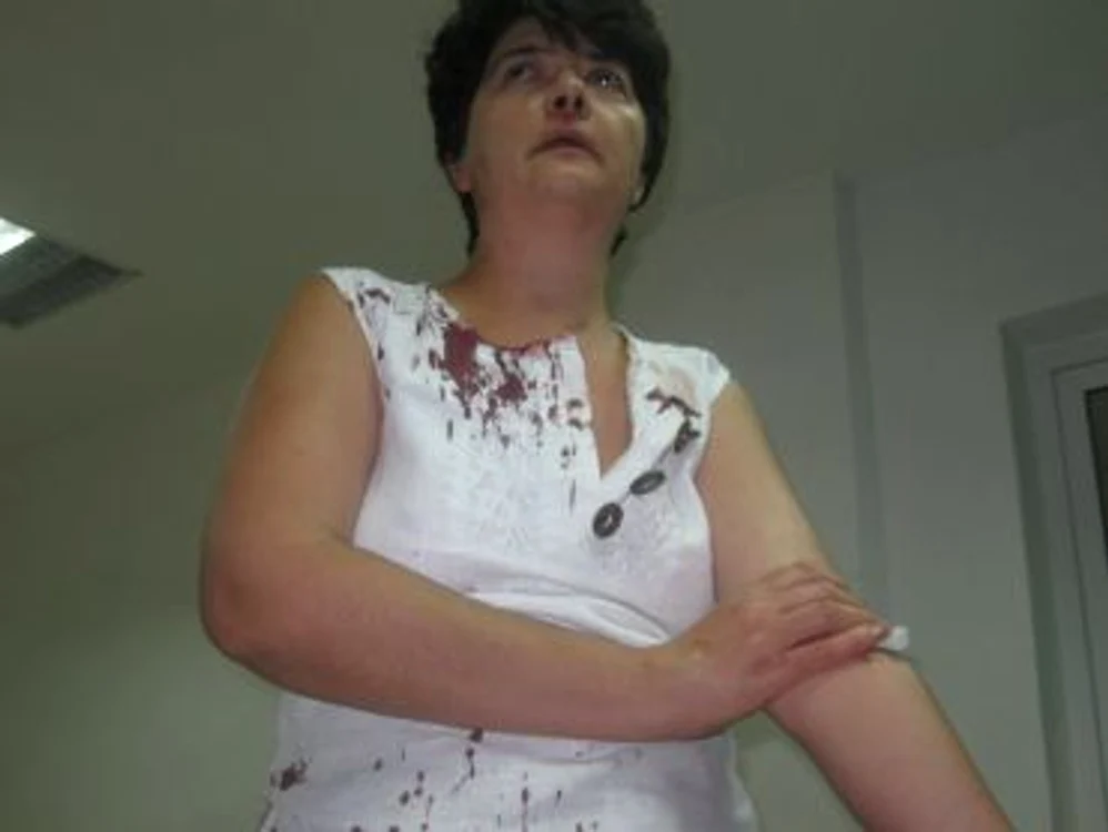
    Carmen Obârşanu a fost umplută de sânge de membrii clanului de rromi  