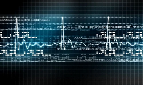 electrocardiograma jpeg