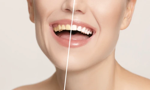 shutterstock 777706525 jpg