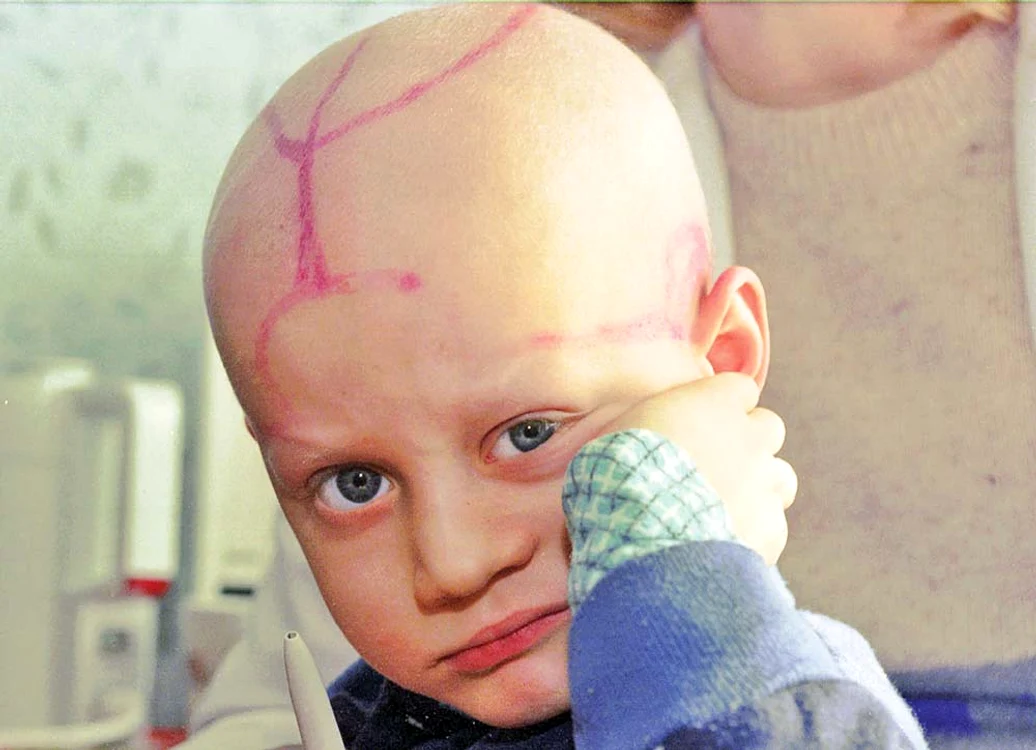 1996: Copiii născuţi după accidentul nuclear au suferit malformaţii majore