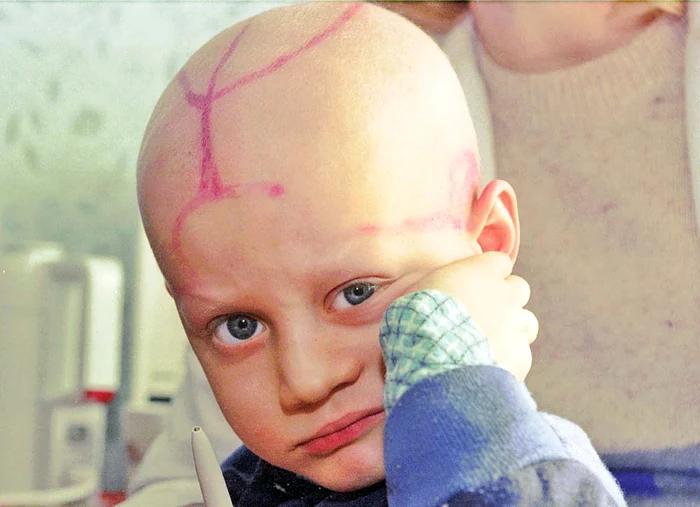1996: Copiii născuţi după accidentul nuclear au suferit malformaţii majore