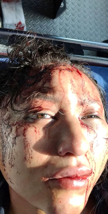 Aşa arătau rănile lui Viri