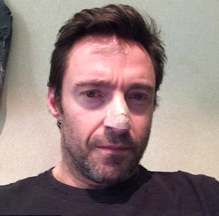 hugh jackman