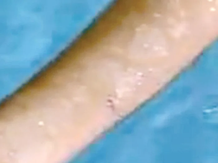 Urmele tăieturilor  sunt vizibile pe  mâinile Mădălinei