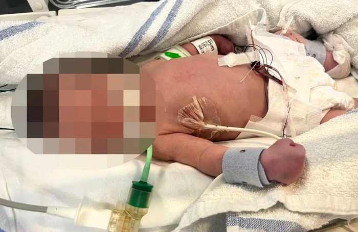 Possie s-a născut cu tibia ruptă și un plămân perforat / foto: social media 