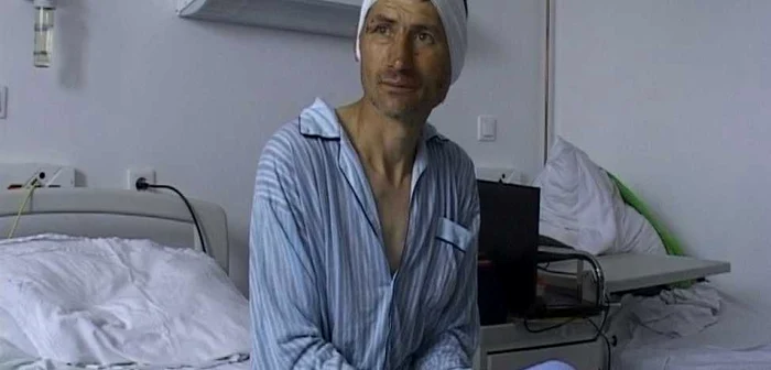 Barbatul a ajuns la spital plin de vanatai si fara o bucata din ureche FOTO Adevarul
