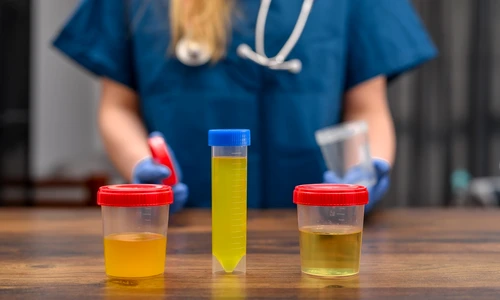 shutterstock 2475991347 jpg