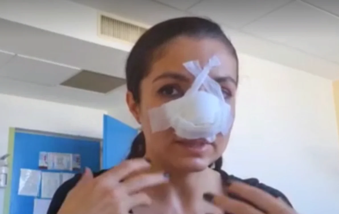 
    Cristina Joia a avut nevoie de operație la nasFoto: Captură Video  