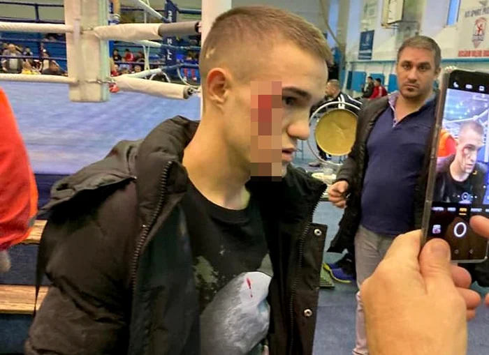 Gabriel Șchiopu, cu arcada spartăfoto: Playsport