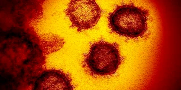 Coronavirus la microscop Foto via NIAID-RML