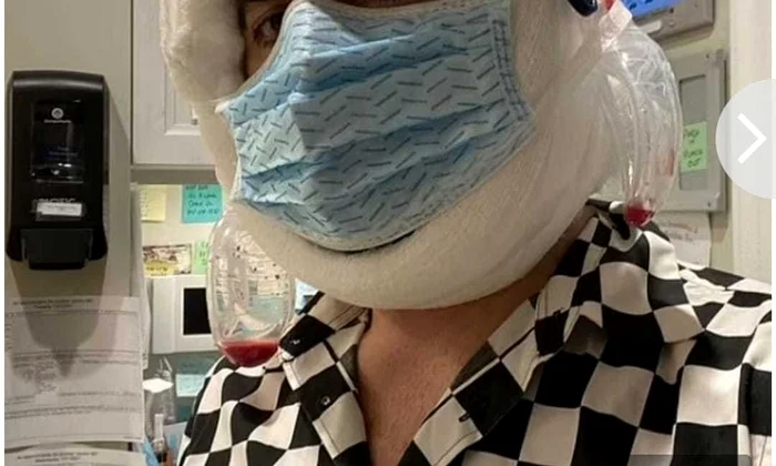 1 marc jacobs operat jpg jpeg