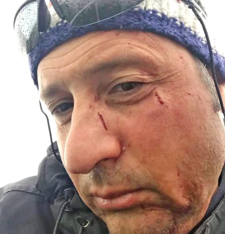 
    Aşa arată Daniel  Petrescu, după  întâlnirea  cu huliganii   