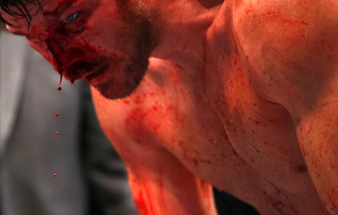 
    Aşa arăta Michael Bisping după lupta cu Anderson Silva foto: gettyimages  