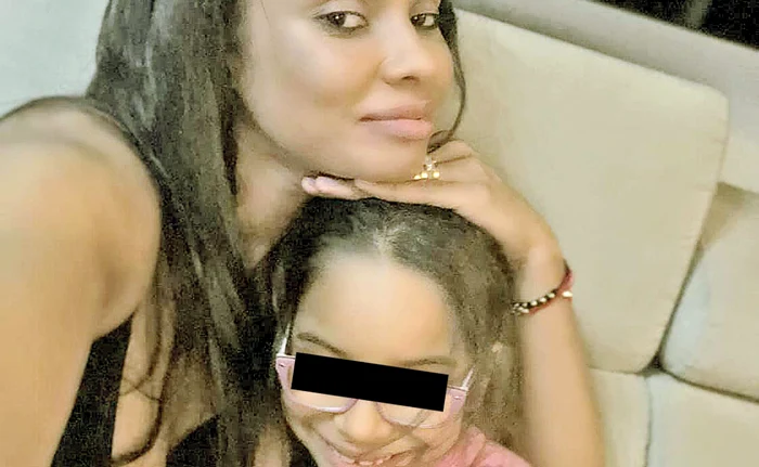 
    Fetiţa lui Laurette a fost îmbrâncită  de un coleg, iar în cădere  şi-a spart dintele  