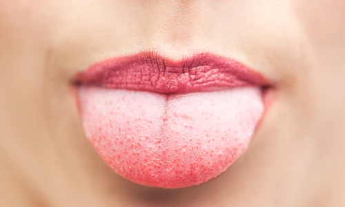 1 shutterstock 154811243 jpg jpeg