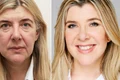 Cum sa arati cu 10 ani mai tanara fara lifting facial  jpg