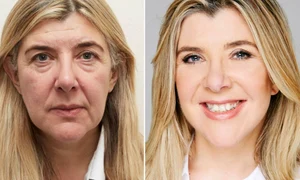 Cum sa arati cu 10 ani mai tanara fara lifting facial  jpg