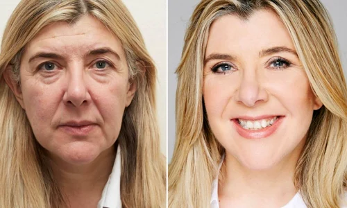 Cum sa arati cu 10 ani mai tanara fara lifting facial  jpg