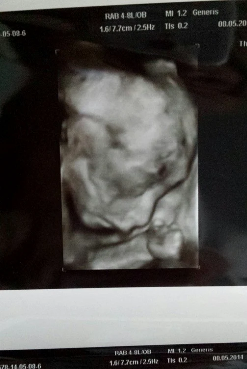 Copil beyonce de romania