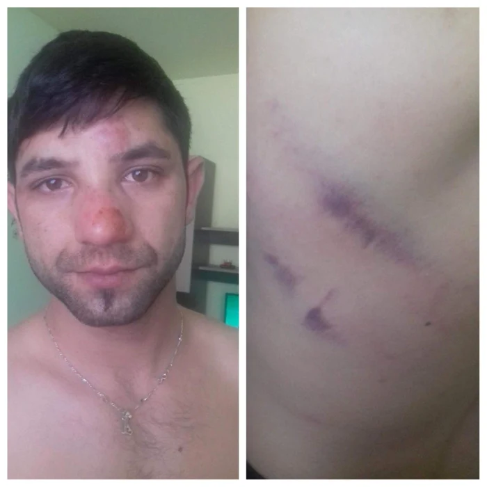 Tânărul susţine că a fost bătut în sediul poliţiei din Ocna Mureş