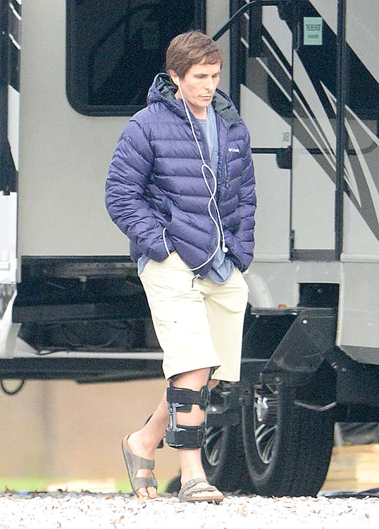 Bale s-a rănit grav la piciorul drept